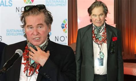 val kilmer malattia